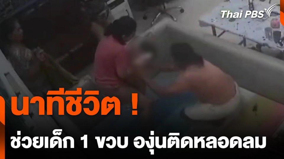 นาทีชีวิต ! ช่วยเด็ก 1 ขวบ องุ่นติดหลอดลม