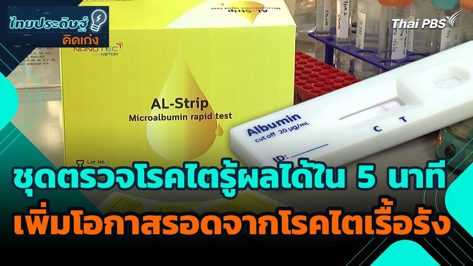 ไทยประดิษฐ์คิดเก่ง : ชุดตรวจโรคไตรู้ผลได้ใน 5 นาที เพิ่มโอกาสรอดจากโรคไตเรื้อรัง