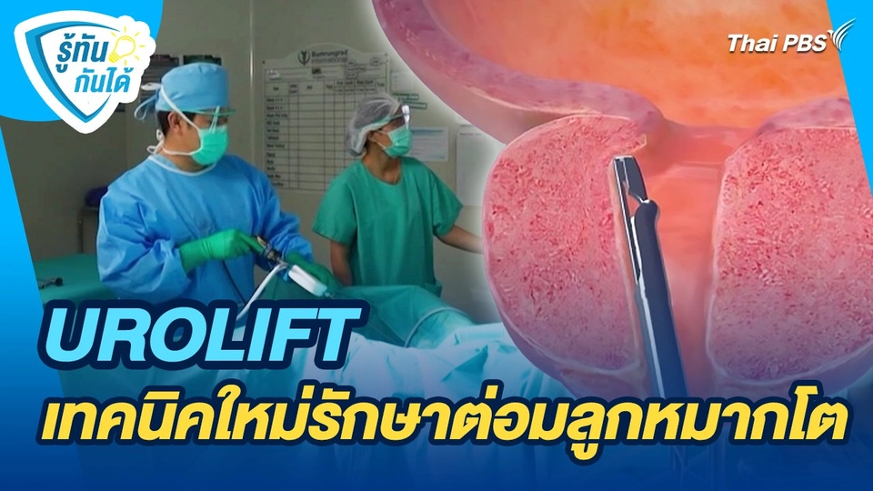 รู้ทันกันได้ : UROLIFT เทคนิคใหม่รักษาต่อมลูกหมากโต