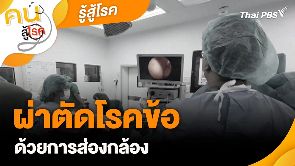 รู้สู้โรค : ผ่าตัดโรคข้อด้วยการส่องกล้อง