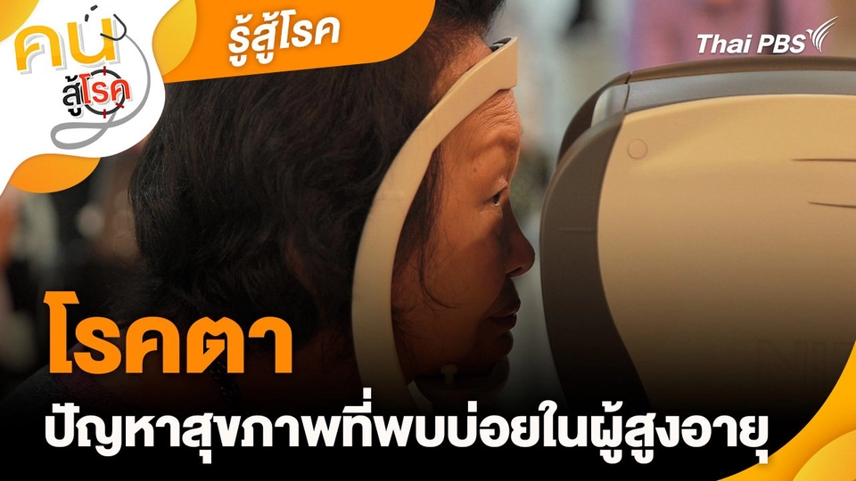 รู้สู้โรค : โรคตาปัญหาสุขภาพที่พบบ่อยในผู้สูงอายุ