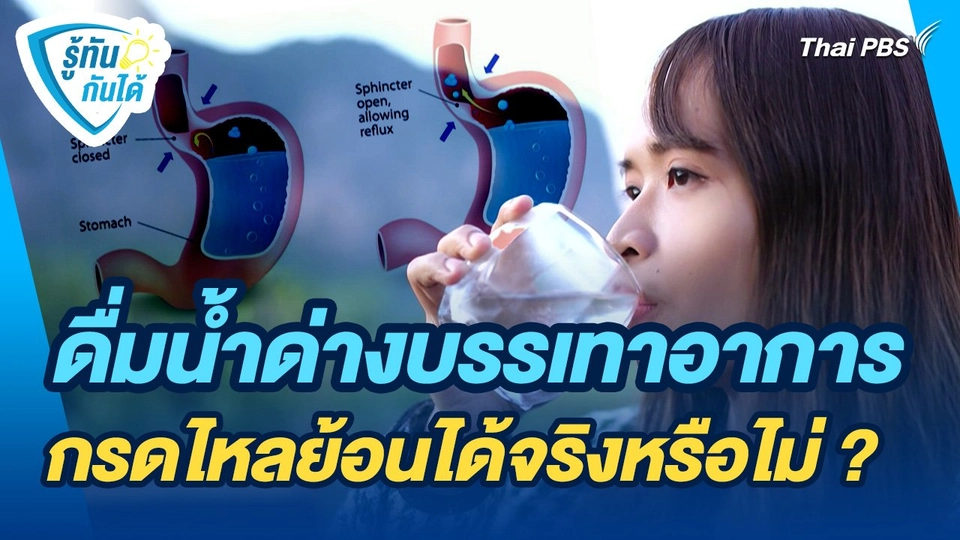 รู้ทันกันได้ : ดื่มน้ำด่างบรรเทาอาการกรดไหลย้อนได้จริงหรือไม่ ?