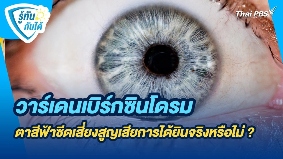 รู้ทันกันได้ : วาร์เดนเบิร์กซินโดรม ตาสีฟ้าซีดเสี่ยงสูญเสียการได้ยินจริงหรือไม่ ?