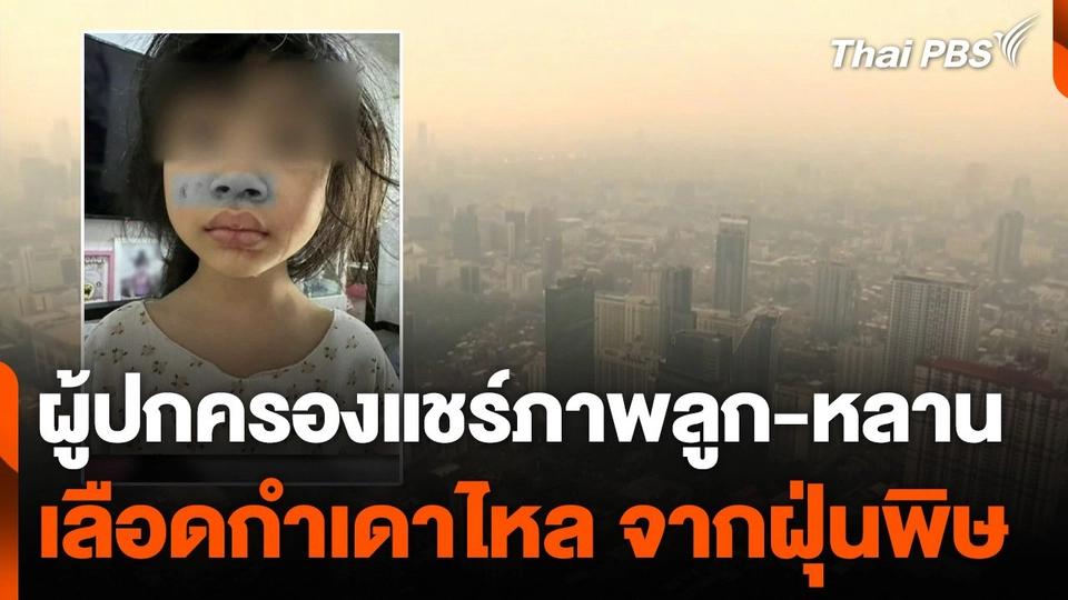 ผู้ปกครองแชร์ภาพลูก-หลาน "เลือดกำเดาไหล" จากฝุ่นพิษ