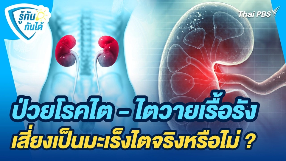รู้ทันกันได้ : ป่วยโรคไต - ไตวายเรื้อรัง เสี่ยงเป็นมะเร็งไตจริงหรือไม่ ?