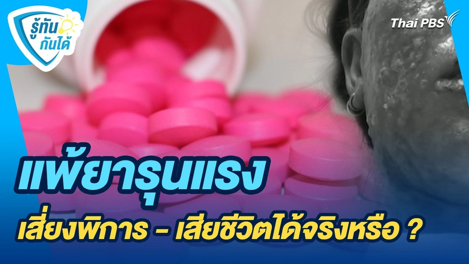 รู้ทันกันได้ : แพ้ยารุนแรง เสี่ยงพิการ - เสียชีวิตได้จริงหรือ ?