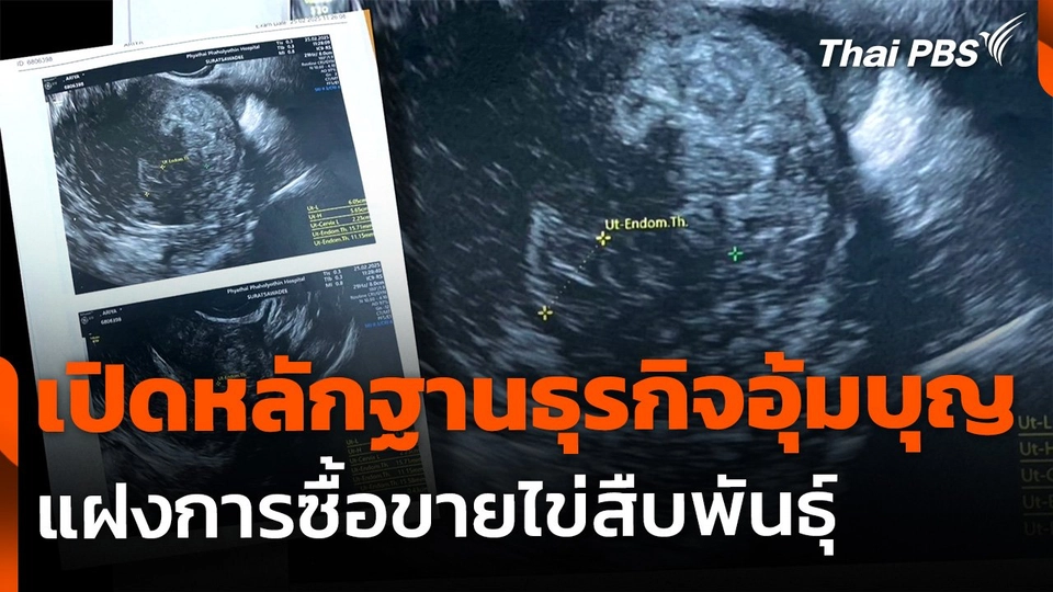 The EXIT : เปิดหลักฐานธุรกิจอุ้มบุญแฝงซื้อขายไข่สืบพันธุ์