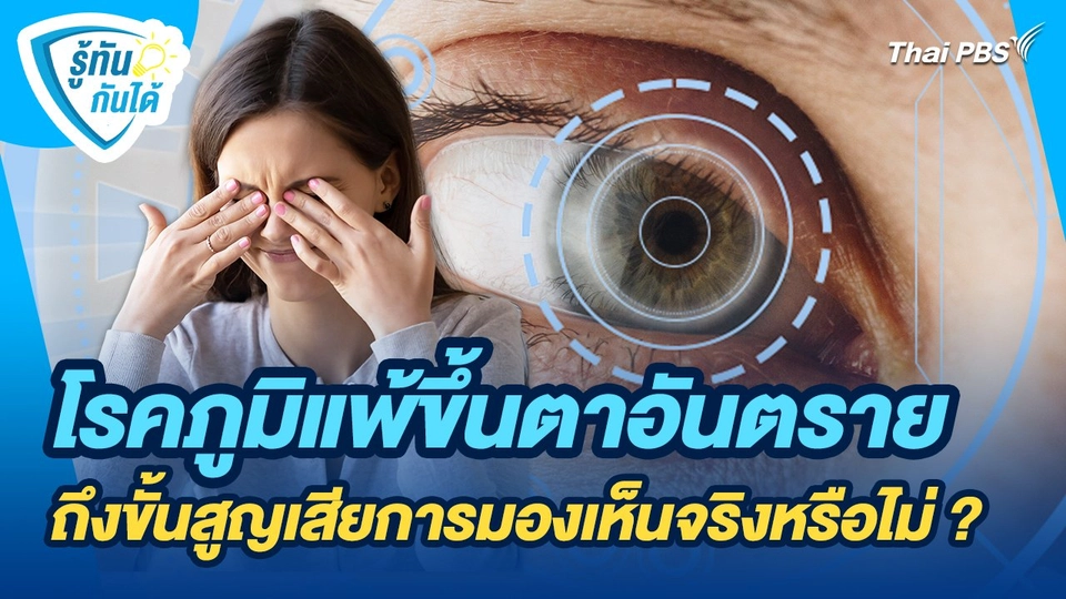 รู้ทันกันได้ : โรคภูมิแพ้ขึ้นตาอันตรายถึงขั้นสูญเสียการมองเห็นจริงหรือไม่ ?