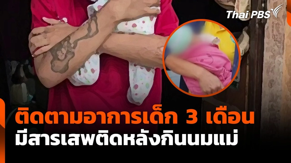 ติดตามอาการเด็ก 3 เดือนมีสารเสพติดหลังกินนมแม่