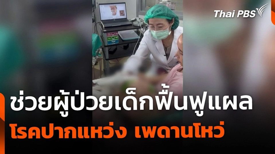 นวัตกรรมช่วยผู้ป่วยเด็ก โรคปากแหว่งเพดานโหว่