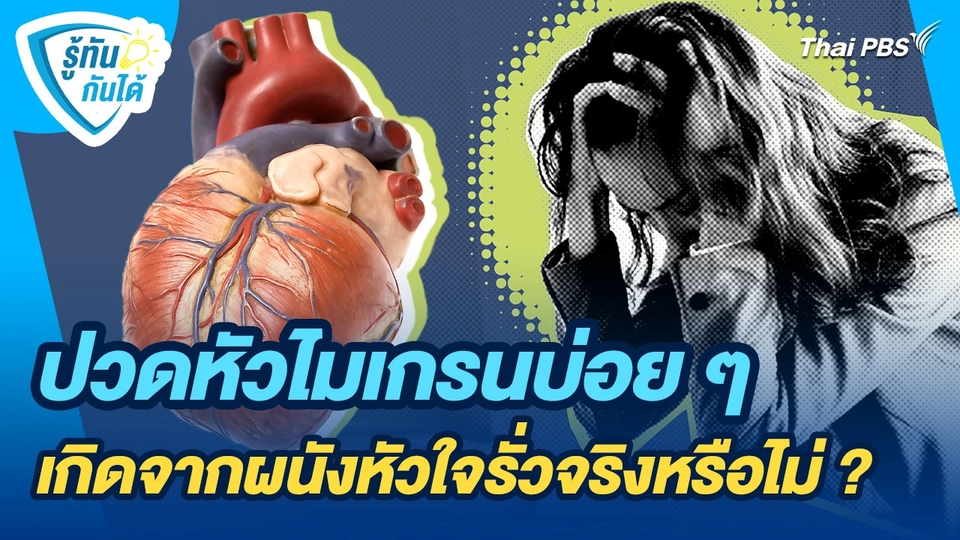 รู้ทันกันได้ : ปวดหัวไมเกรนบ่อย ๆ เกิดจากผนังหัวใจรั่วจริงหรือไม่ ?