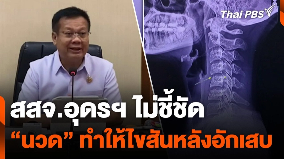 สสจ.อุดรฯ ไม่ชี้ชัด "นวด" ทำให้ไขสันหลังอักเสบ