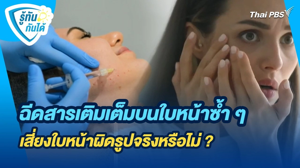 รู้ทันกันได้ : ฉีดสารเติมเต็มบนใบหน้าซ้ำ ๆ เสี่ยงใบหน้าผิดรูปจริงหรือไม่ ?