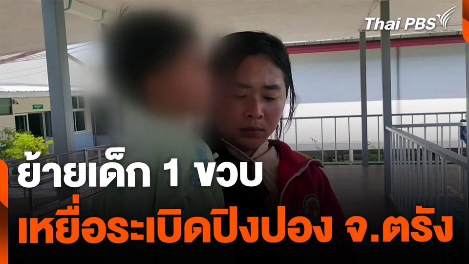 ย้ายด่วน เด็ก 1 ขวบ เหยื่อระเบิดปิงปอง จ.ตรัง