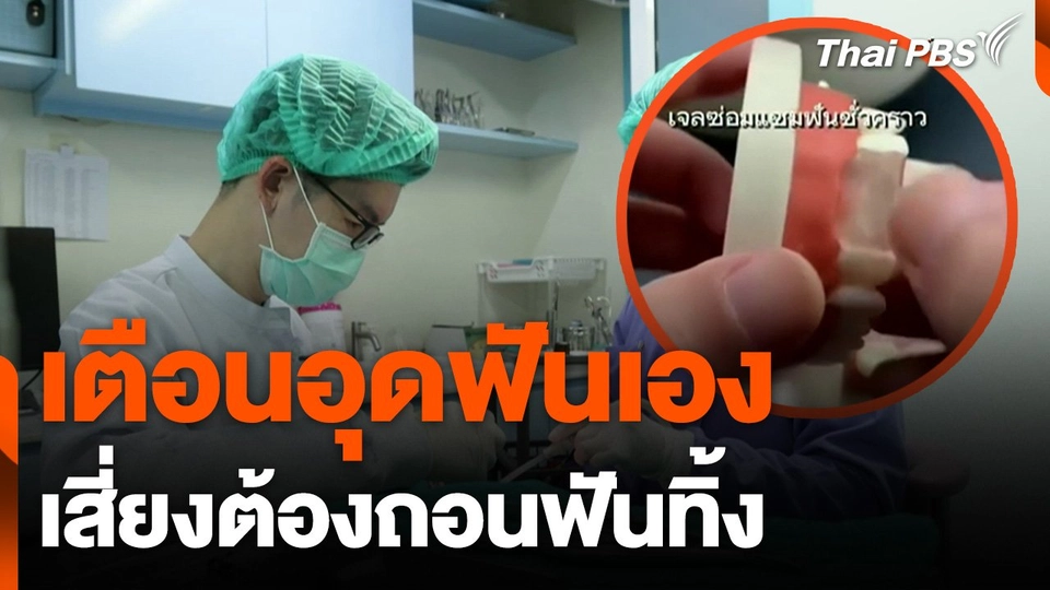 ทันตแพทย์ เตือน "อุดฟันเอง" เสี่ยงต้องถอนฟันทิ้ง