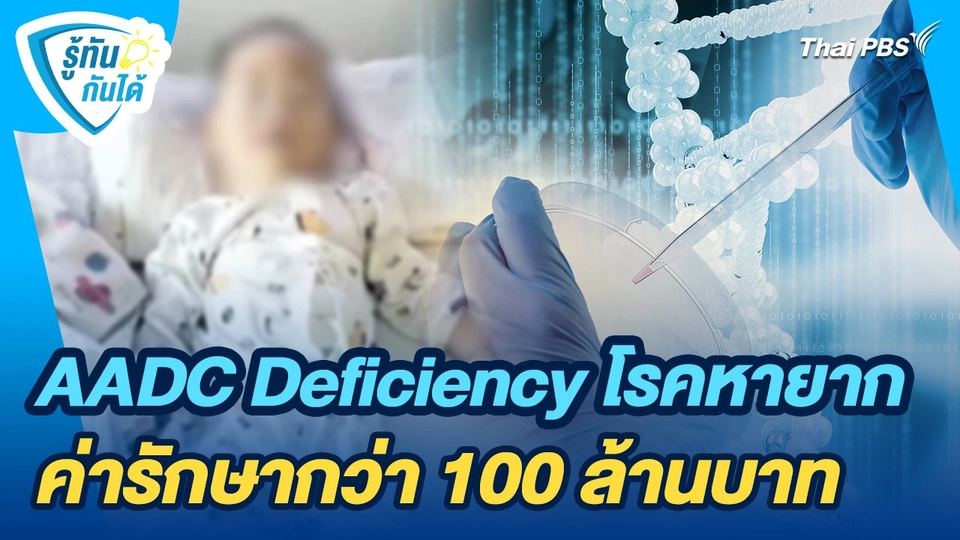 รู้ทันกันได้ : AADC Deficiency โรคหายาก ค่ารักษากว่า 100 ล้านบาท