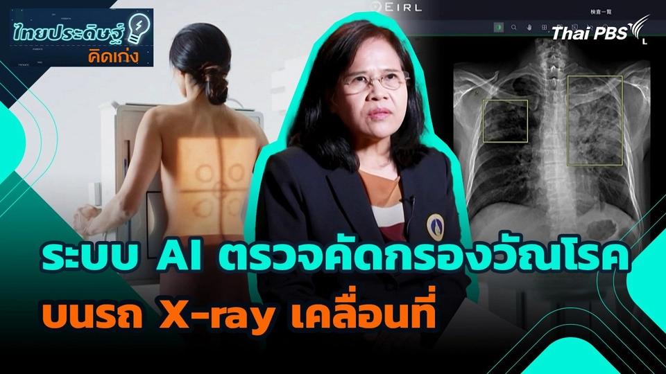 ไทยประดิษฐ์คิดเก่ง : ระบบ AI ตรวจคัดกรองวัณโรคบนรถ X-ray เคลื่อนที่