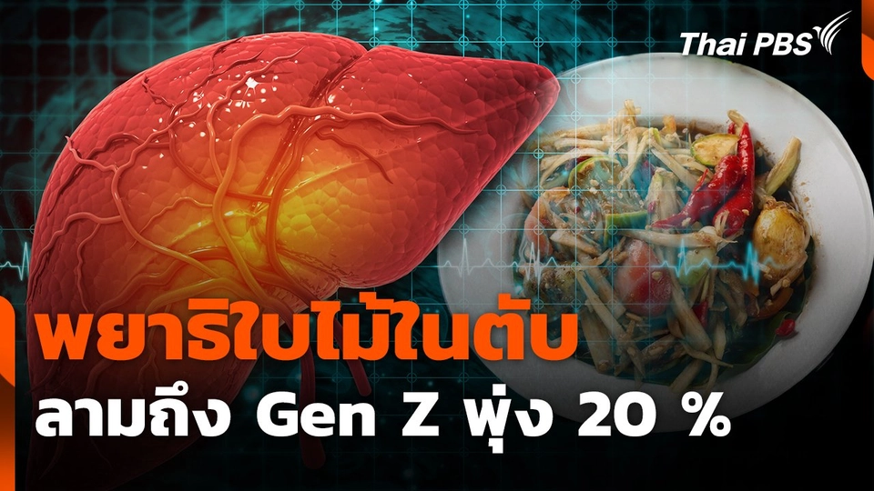 พยาธิใบไม้ในตับลามถึง Gen Z พุ่ง 20 %