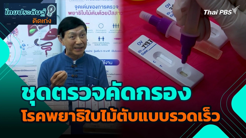 ชุดตรวจคัดกรองโรคพยาธิใบไม้ตับแบบรวดเร็ว