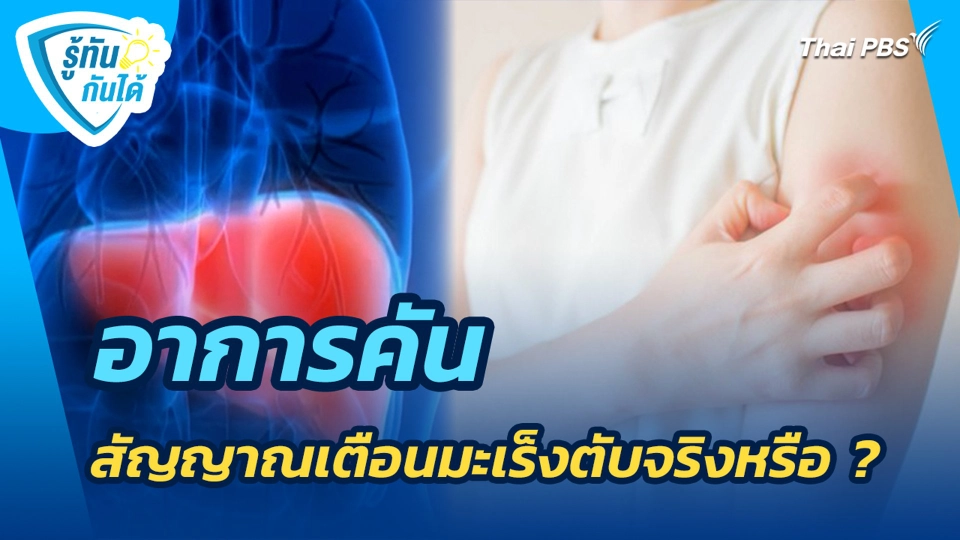 อาการคันสัญญาณเตือนมะเร็งตับจริงหรือ ?