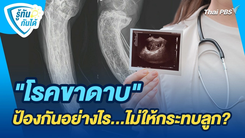 รู้ทันกันได้ : "โรคขาดาบ" ป้องกันอย่างไร...ไม่ให้กระทบลูก?