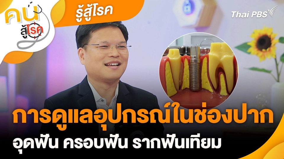 รู้สู้โรค : การดูแลอุปกรณ์ในช่องปาก อุดฟัน ครอบฟัน รากฟันเทียม