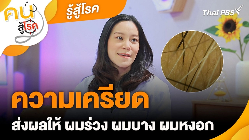 รู้สู้โรค : ความเครียดส่งผลให้ ผมร่วง ผมบาง ผมหงอก