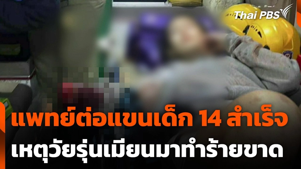 แพทย์ต่อแขนเด็กอายุ 14 ปีสำเร็จ เหตุวัยรุ่นเมียนมาทำร้ายขาด