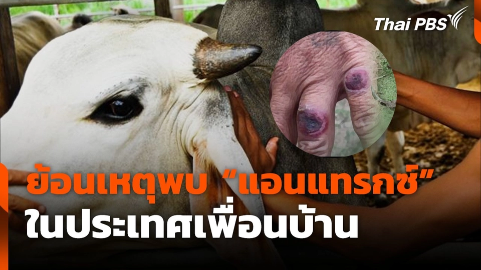 ย้อนเหตุพบ "แอนแทรกซ์" ในประเทศเพื่อนบ้าน