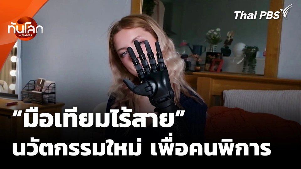 "มือเทียมไร้สาย" นวัตกรรมเพื่อคนพิการ