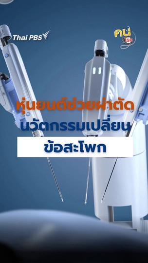 หุ่นยนต์ช่วยผ่าตัด นวัตกรรมเปลี่ยนข้อสะโพก | #คนสู้โรค