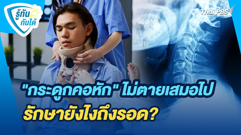 รู้ทันกันได้ : "กระดูกคอหัก" ไม่ตายเสมอไป รักษายังไงถึงรอด?
