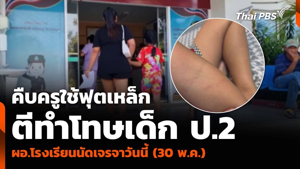 คืบครูใช้ฟุตเหล็กตีทำโทษเด็ก ป.2 ผอ.โรงเรียนนัดเจรจาวันนี้ (30 พ.ค.)