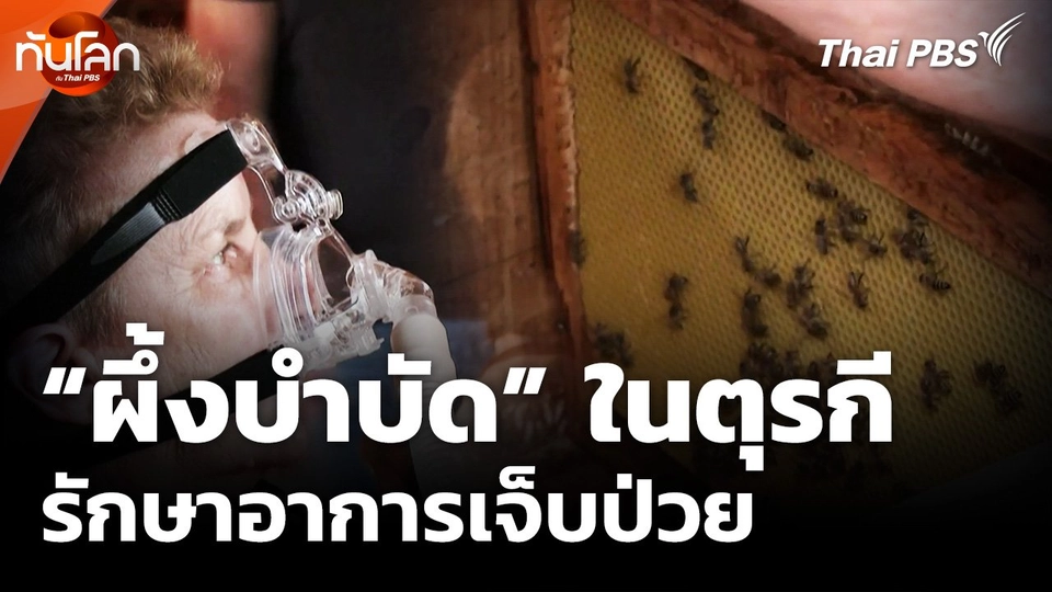 คนเลี้ยงผึ้งในตุรกีคิดค้น "ผึ้งบำบัด" รักษาอาการเจ็บป่วย