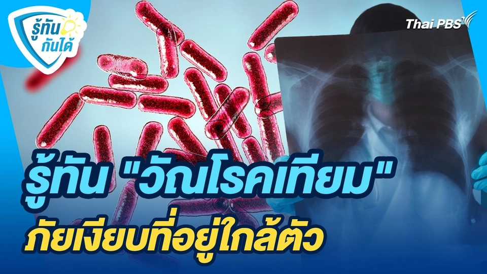 รู้ทันกันได้ : รู้ทัน "วัณโรคเทียม" ภัยเงียบที่อยู่ใกล้ตัว
