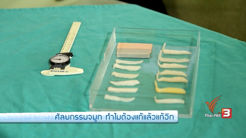 รู้สู้โรค : ศัลยกรรมจมูก ทำไมต้องแก้แล้วแก้อีก