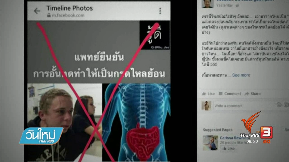 คลิกให้ปัง : นักวิทยาศาสตร์ชี้ "กลั้นผายลมไม่เป็นกรดไหลย้อน"