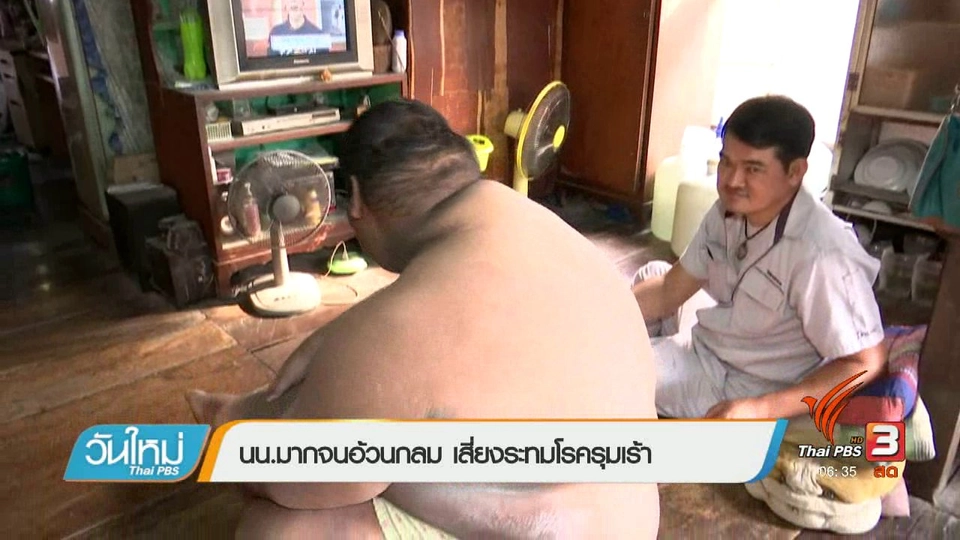 108 สุขภาพ : น้ำหนักมากจนอ้วนกลม เสี่ยงระทมโรครุมเร้า