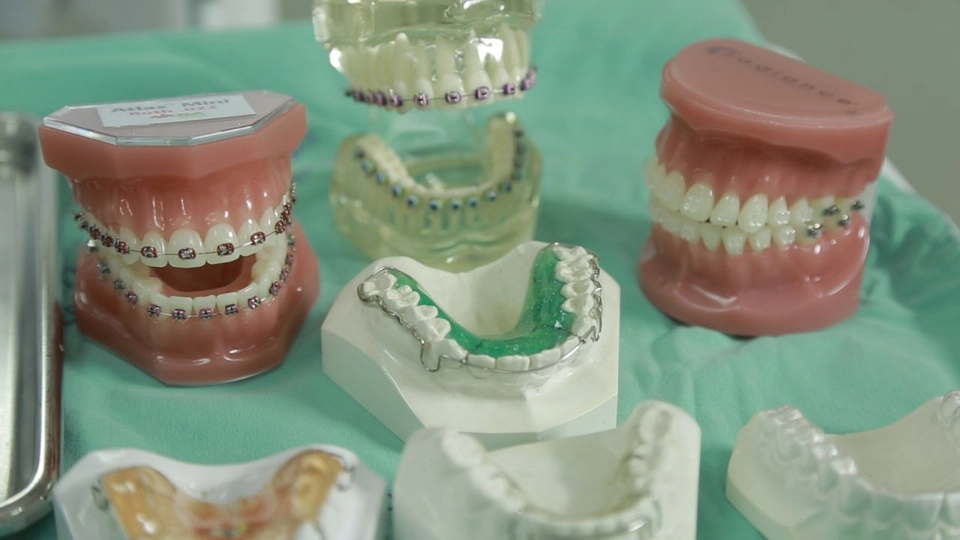 อันตรายจากการจัดฟันแฟชั่น