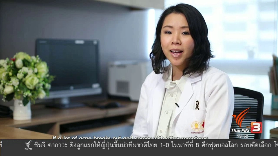 soเชี่ยว FAKE or FACT : ตำแหน่งของสิวบอกโรคได้จริงหรือไม่