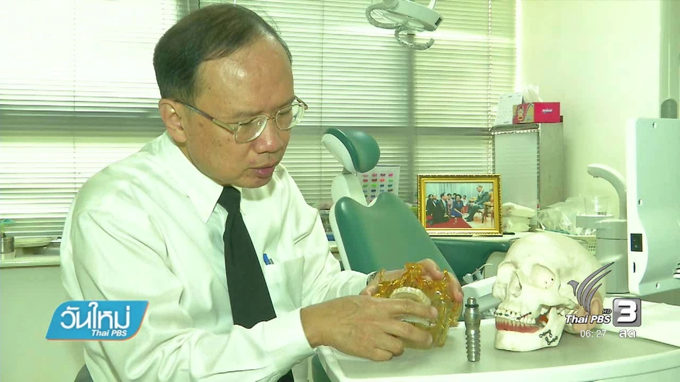 โครงการรากฟันเทียมเฉลิมพระเกียรติ