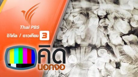 คิดนอกจอ : เด็กชายประสบภาวะฟันเกินราว 300 ซี่