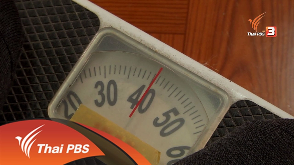 โรคกลัวอ้วน