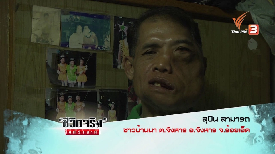 สุบิน หัวใจไม่ผิดรูป