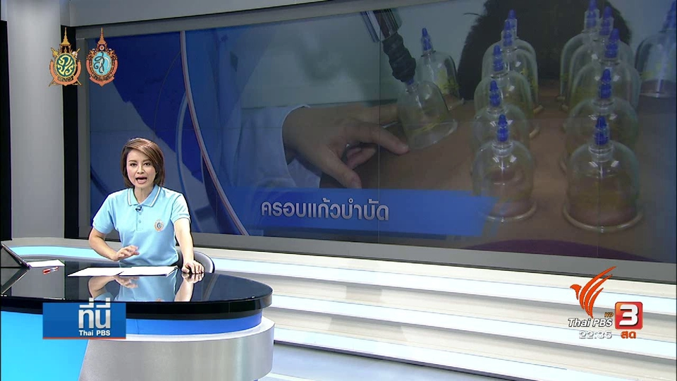 ที่นี่ Thai PBS : ครอบแก้วบำบัด