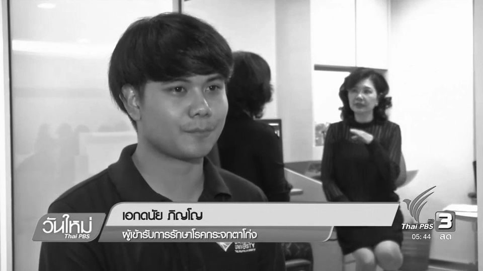 สายตาสั้นเปลี่ยนแว่นบ่อย-ขยี้ตารุนแรง สัญญาณ "กระจกตาโก่ง"
