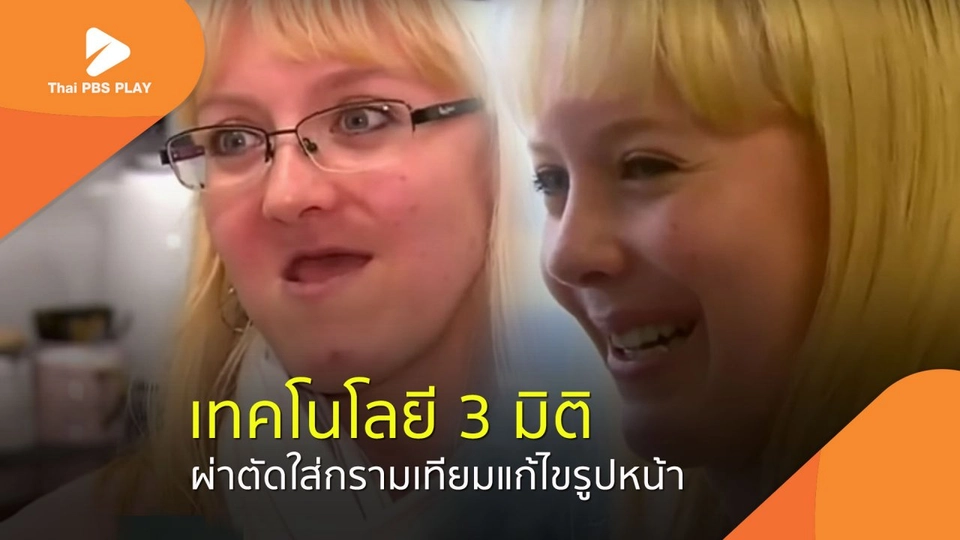 ผ่าตัดใส่กรามเทียมแก้ไขรูปหน้า