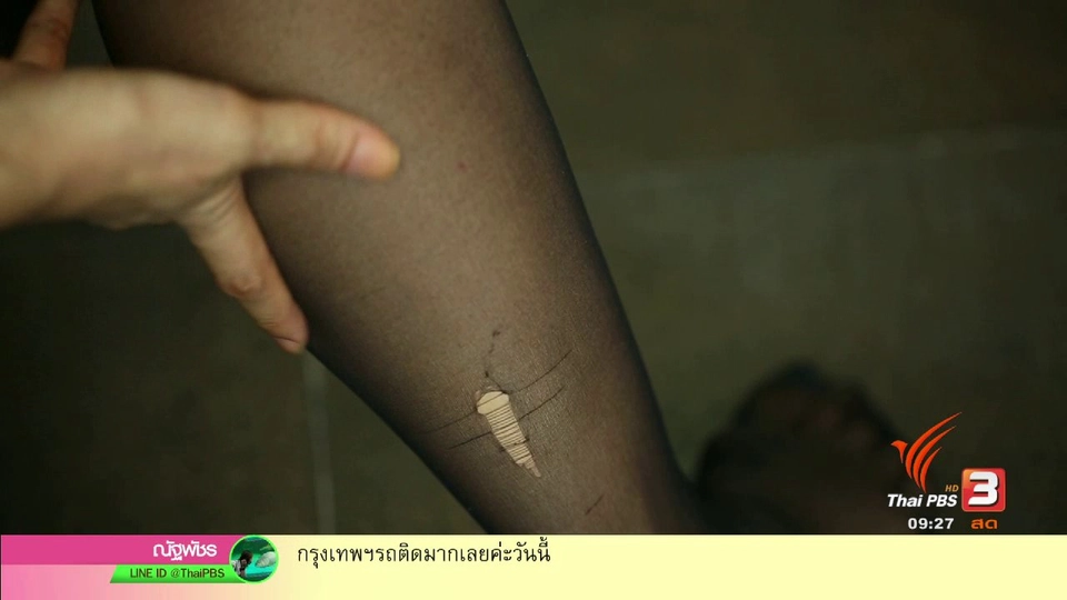 สุดยอดแม่บ้าน : วิธียืดอายุการใช้งานถุงน่อง