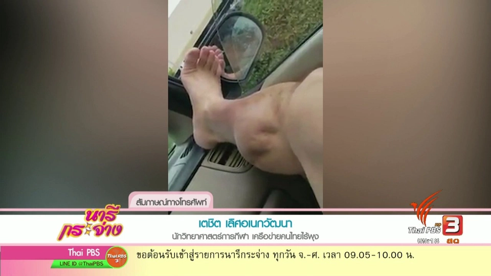 นารีสนทนา : ตะคริวกับการออกกำลังกาย