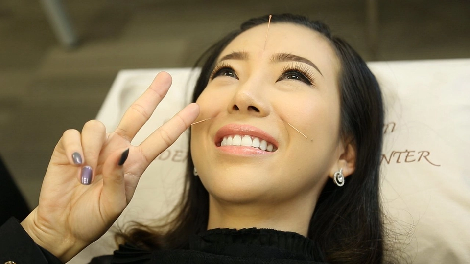 ฝังเข็มแก้โรคภูมิแพ้